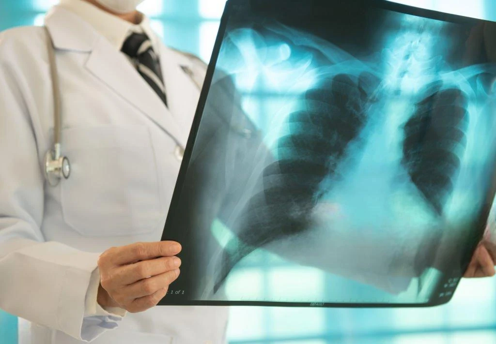 image about طب الأشعة والتصوير الشعاعي: عين الطب الحديث ومستقبل التشخيص الرقمي