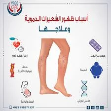 image about مرض محمود الخطيب الذي أبعده عن رئاسة النادي الأهلي: تحليل شامل