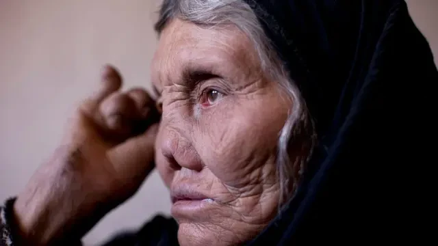 image about مرض الجذام.. بين الوصمة والعلاج: هل ما زال يشكل خطرًا؟