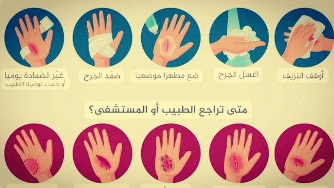 image about معلومات هامه عن الاسعافات الأولية