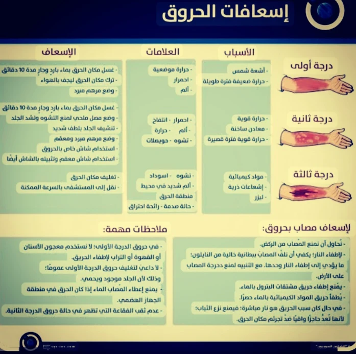 image about معلومات هامه عن الاسعافات الأولية