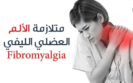 image about متلازمه الألم العضلي الليفي