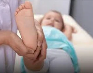 image about الفلات فوت عند الاطفال