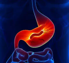 image about علاج جرثومة المعدة نهائيًا في 14 يومًا فقط