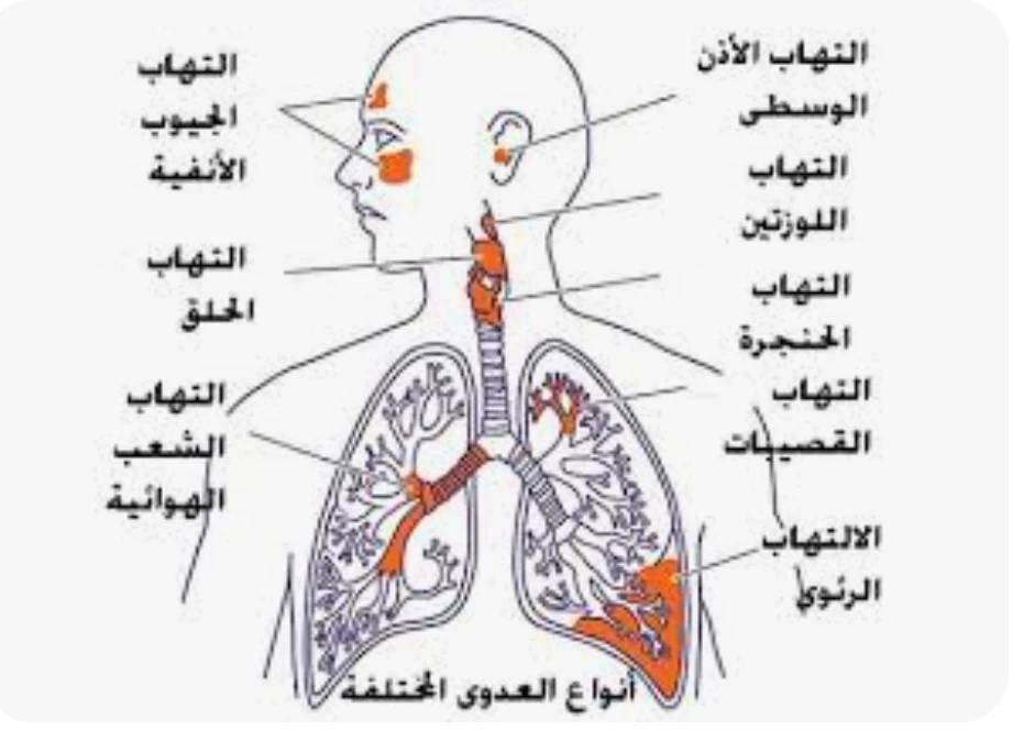 image about 