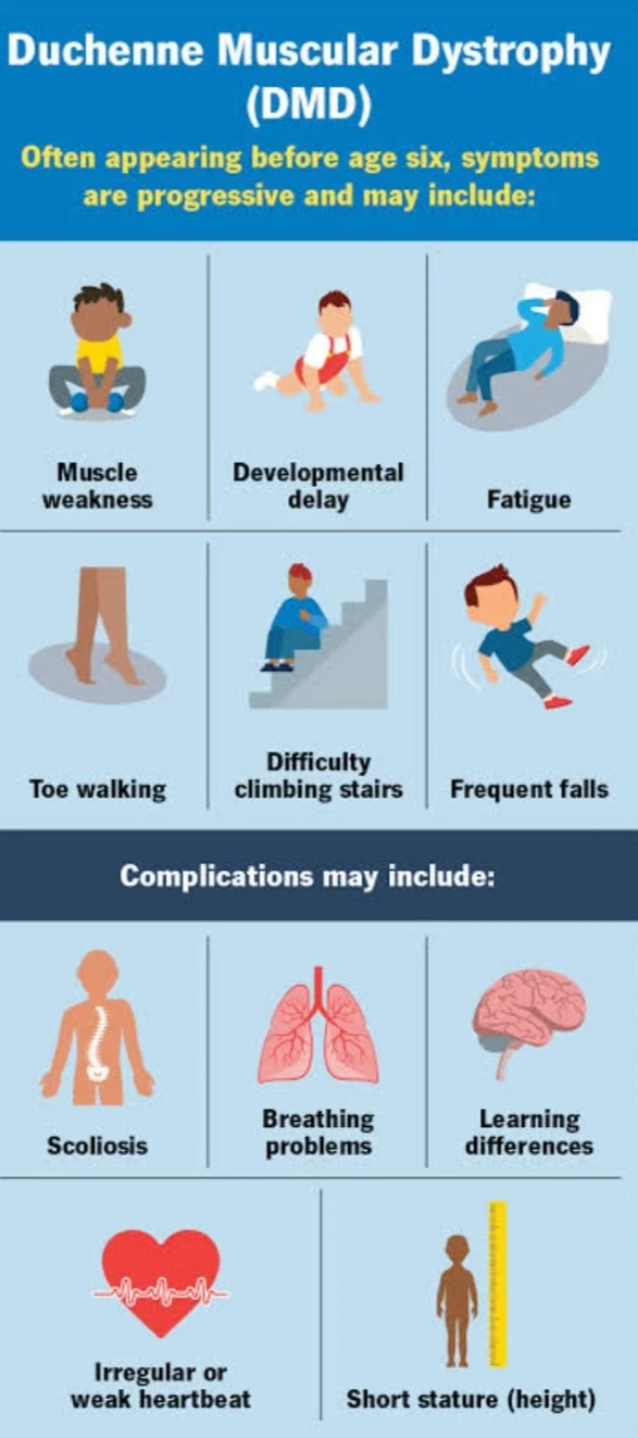 image about الضمور العضلي الدوشيني: أسبابه وأعراضه ودور التغذية العلاجية في العلاج