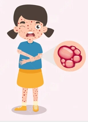 image about حساسيه الماء ( الشري المائي )