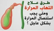 image about المراره الملتهبه المؤلمه