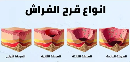 image about صحه الجلد في مواجهه الضغط