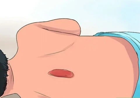 image about صحه الجلد في مواجهه الضغط