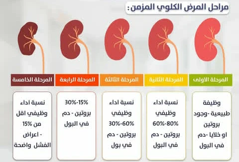 image about الفلتر الحيوي الذي قد يتعطل