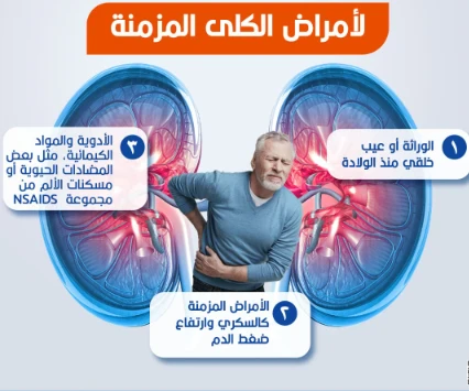 image about الفلتر الحيوي الذي قد يتعطل