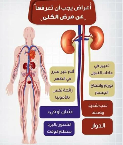 image about الفلتر الحيوي الذي قد يتعطل