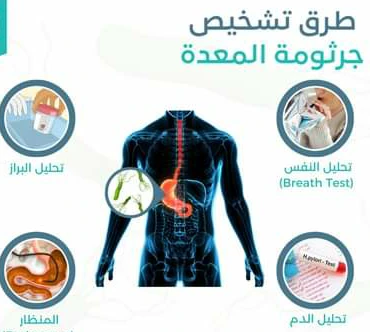 image about عندما تصبح المعده بيئه خطره