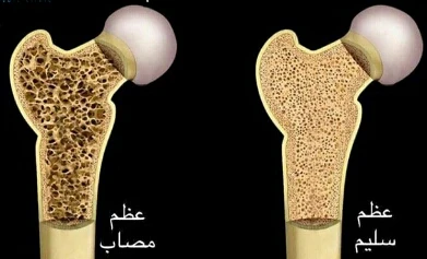 image about حياة بلا آلام