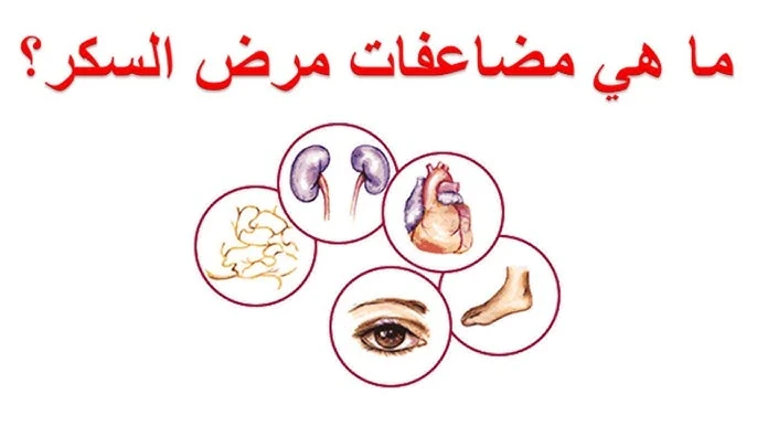 image about كم يجب أن يكون معدل السكر الطبيعي في الدم؟