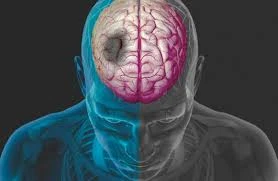 image about الجلطات الدموية: القاتل الصامت وكيفية اكتشافها قبل فوات الأوان