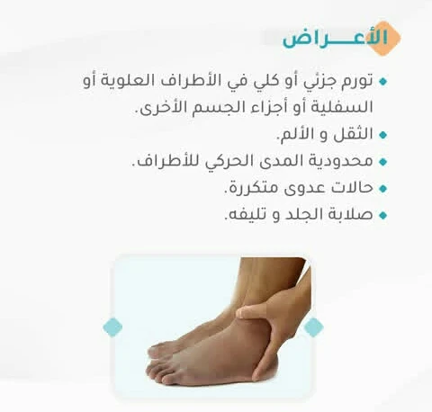 image about التورم الصامت ( الوذمه )