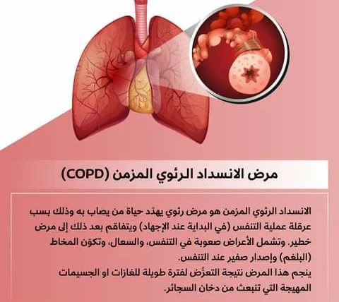 image about الانسداد الرئوي المزمن