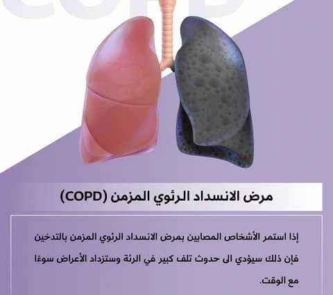 image about الانسداد الرئوي المزمن