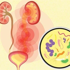 image about بهذه الطريقة يمكنك حماية نفسك من عدوى المسالك البولية