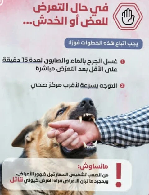image about الفيروس القاتل ( السعار )