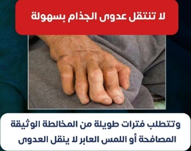 image about الحقيقه وراء مرض الجذام