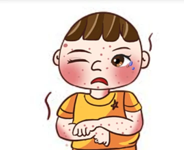 image about الحقيقه وراء مرض الجذام