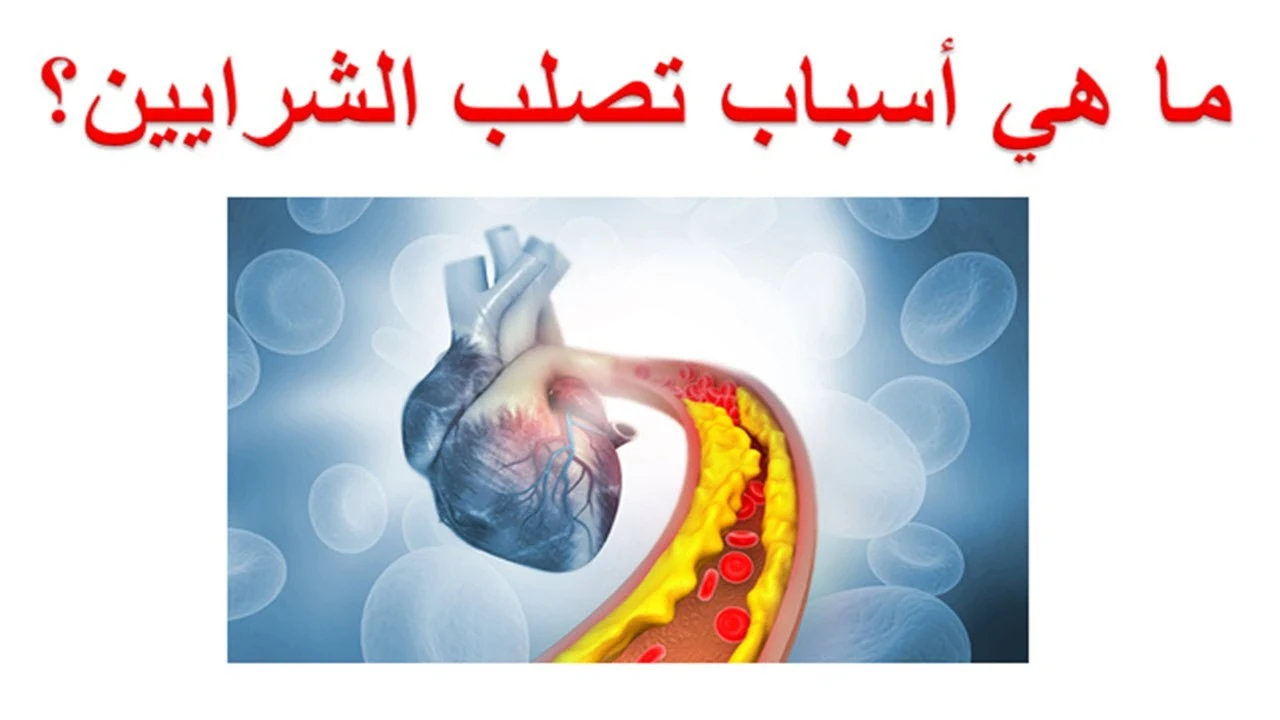 image about تصلب الشرايين لدى مرضى السكري: أعراض، وأسباب، وعلاج