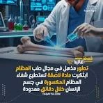 image about علاج العظام فى دقائق ثورة الطب الحيوي المعاصر – ابتكار اللاصق الطبي Bone-02 لعلاج كسور العظام