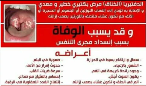 image about الدفتيريا مرض معدي