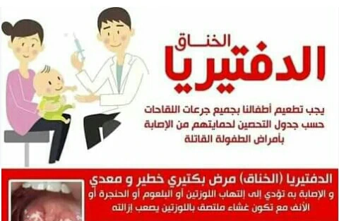image about الدفتيريا مرض معدي