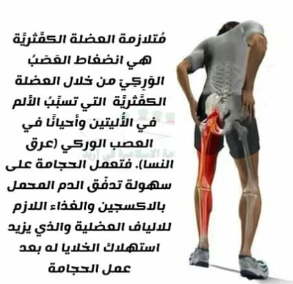 image about عرق النسا الكاذب
