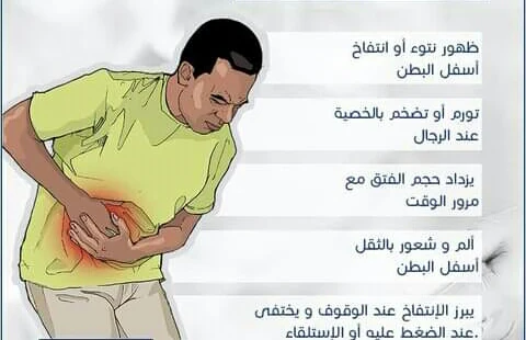 image about أنواع الفتق الشائعه