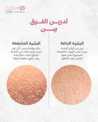 image about جمال البشرة الجافة وكيفية المحافظة عليها ومميزاتها وعيوبها وأسرارها
