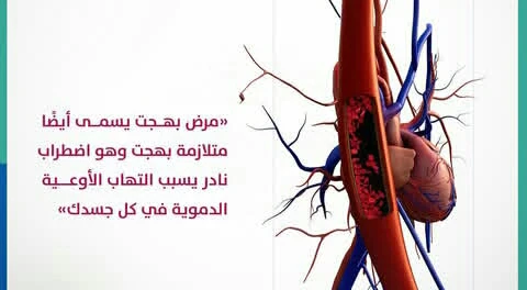 image about مرض الالتهابات النادره