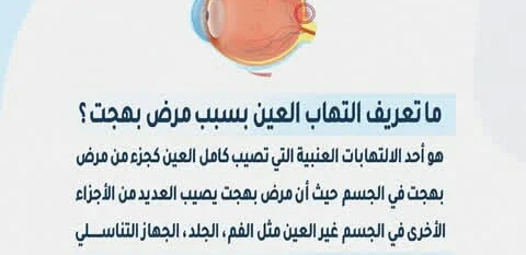 image about مرض الالتهابات النادره