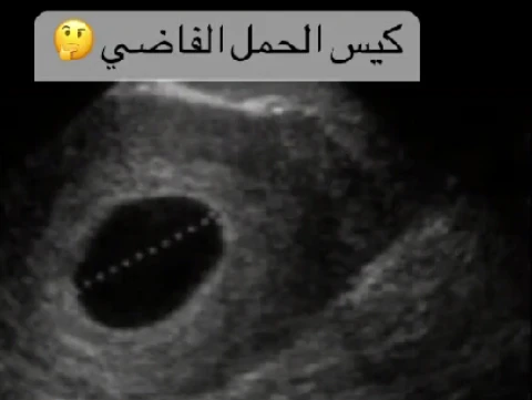 image about عندما يخدع الجسد العقل