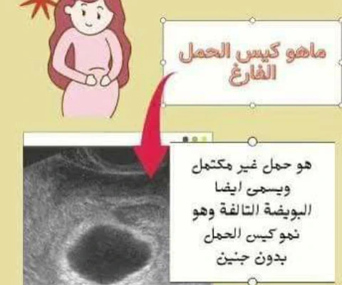 image about عندما يخدع الجسد العقل