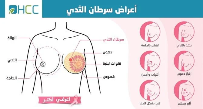 image about ما هي أعراض مرض سرطان الثدي؟