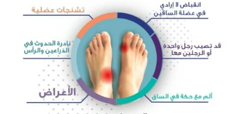 image about عندما يسرق التململ النوم