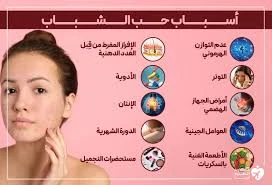 image about علاج حب الشباب عند البنات بطرق طبيعية فعالة | أسرار البشرة النقية بدون أدوية