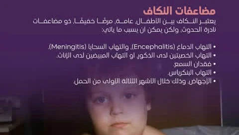 image about التورم المؤلم للغده اللعابيه