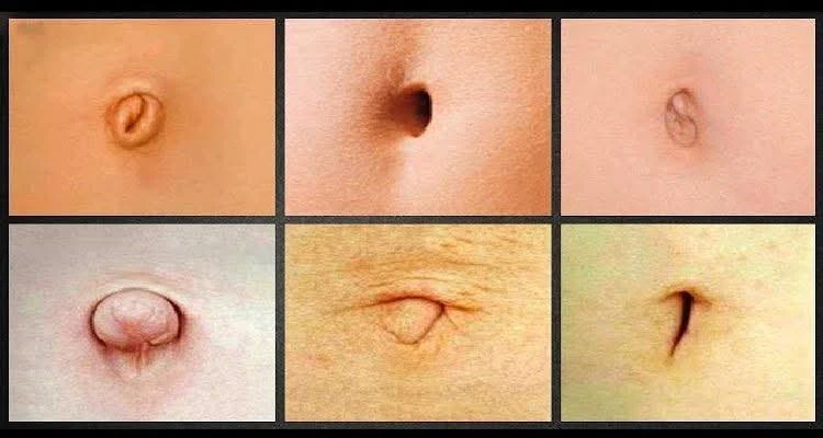 image about سرّة البطن: نافذة على الصحة أم مجرد نُدبة؟ حقيقة ما تكشفه سرّتك عن صحتك