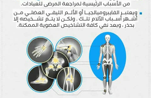 image about متلازمه الألم المزمن والتعب الشديد