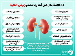 image about انسداد الحالبين وخطر الفشل الكلوي الحاد… الأسباب والأعراض وطرق العلا