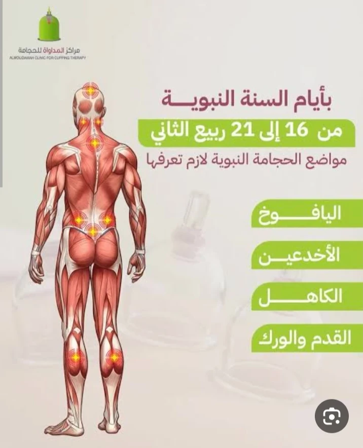 image about فوائد الحجامه للجسم