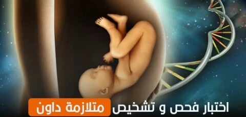 image about أهميه التدخل المبكر والاندماج الاجتماعي