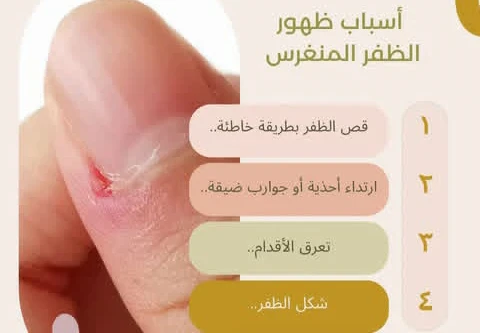 image about من القص الخاطئ الي العدوى الخطيره