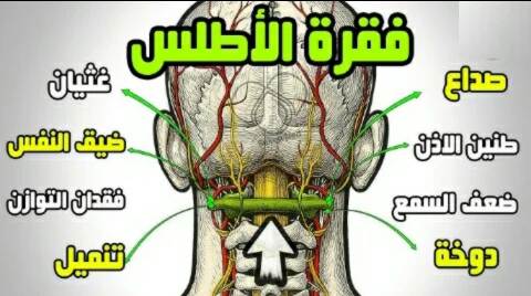 image about البطل الخارق الذي يحمل جمجمتك